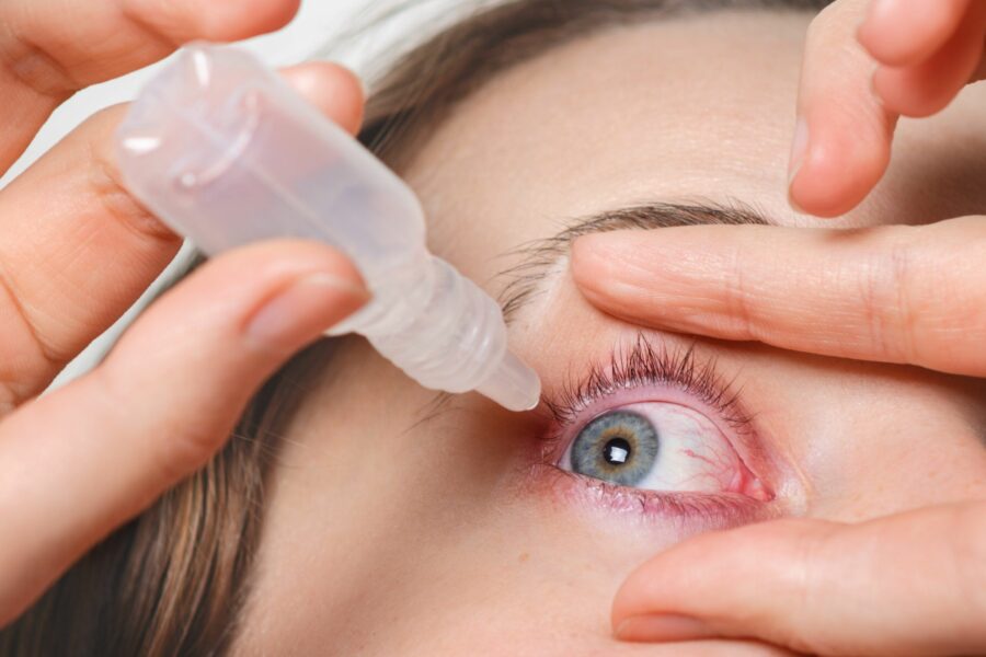 Close do olho uma mulher aplicando lagrima artificial por causa da síndrome do olho seco