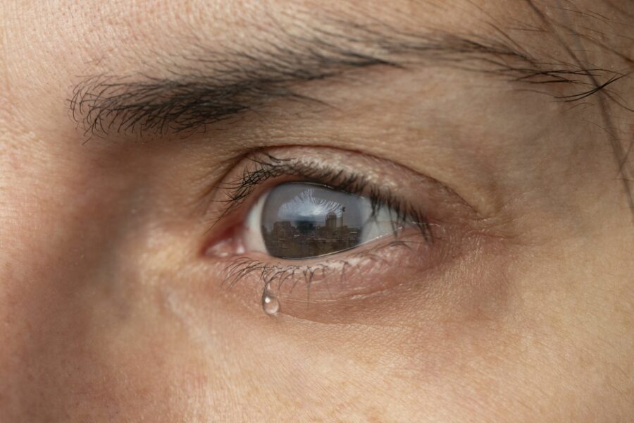 Close de olho de pessoa que tem lacrimejamento excessivo